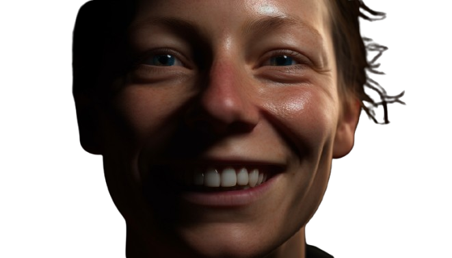Pessoa sorrindo com alinhadores transparentes
